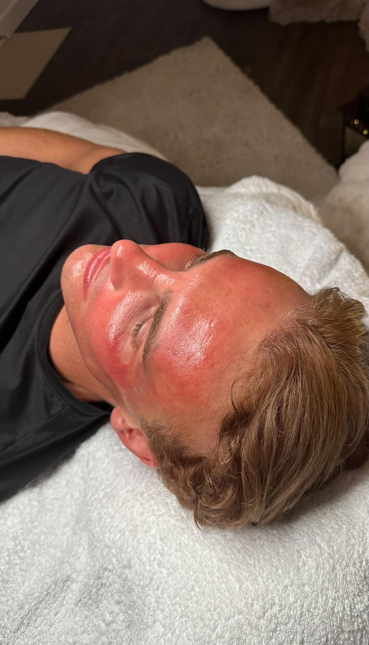 A client resting on the treatment couch after a facial, skin flushed and glowing